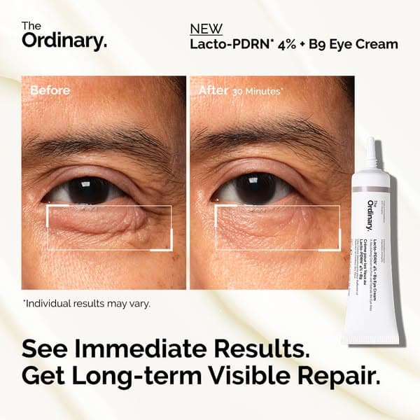 Health and wellness ad example: The Ordinary skincare static Meta ad, before and after format. Side-by-side before and after-30-minutes crops of one eye with the product tube, individual results may vary, see immediate results and long-term repair.